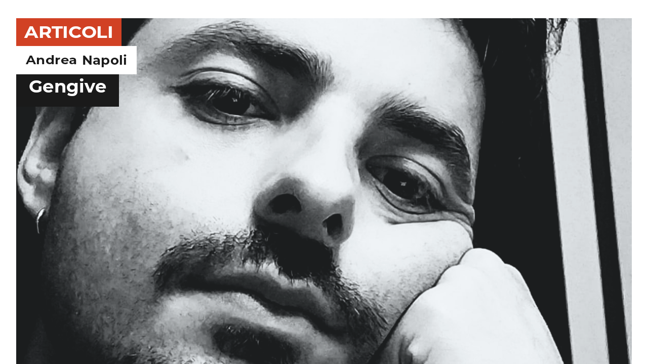 Andrea Napoli | Gengive